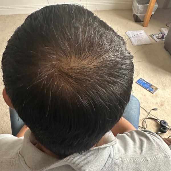 After