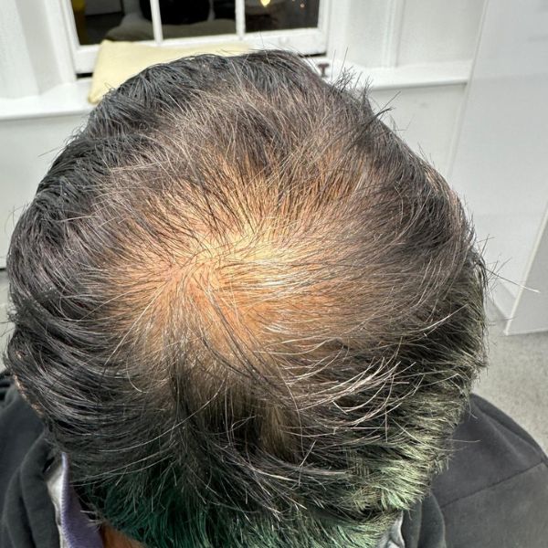 Before