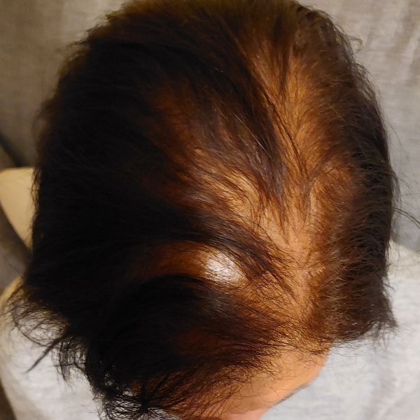 After